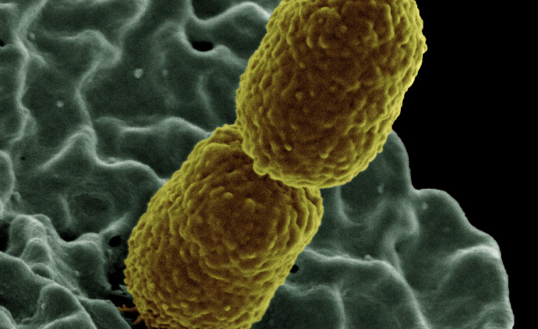 Bacteria muy resistente causa ya miles de muertos en los quirófanos de Europa