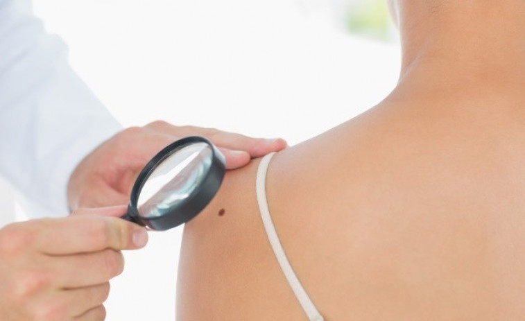 ​Prevención y diagnóstico precoz para frenar la epidemia del cáncer de piel