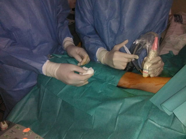 El CHUF realiza nuevas técnicas PICC