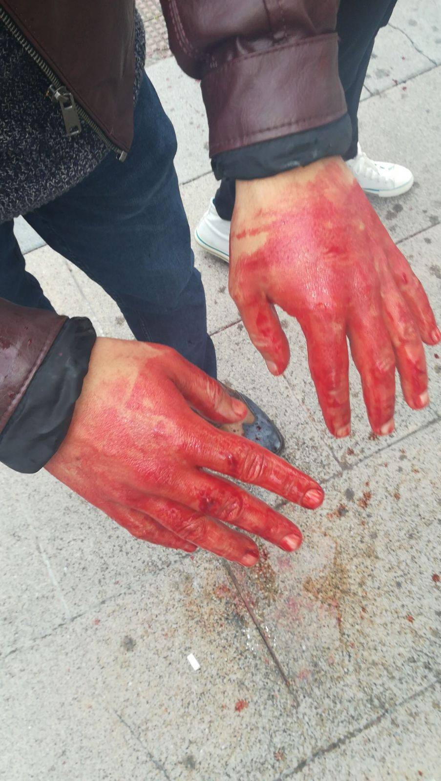 Cargas insuisa coruu00f1