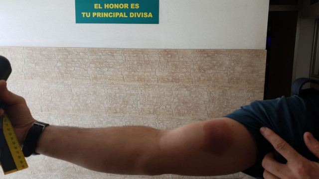 La Guardia Civil evita que un incendio llegue a viviendas en Carballo (A Coruña)