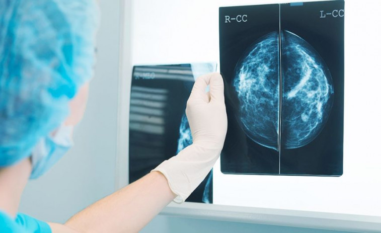 El SERGAS usará Inteligencia Artificial para diagnosticar cáncer