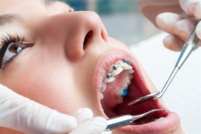 Dentistas dientes