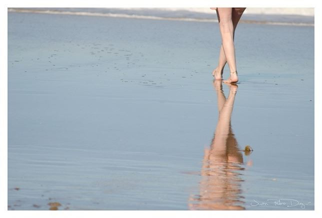 Claves contra las molestias de la varices en verano