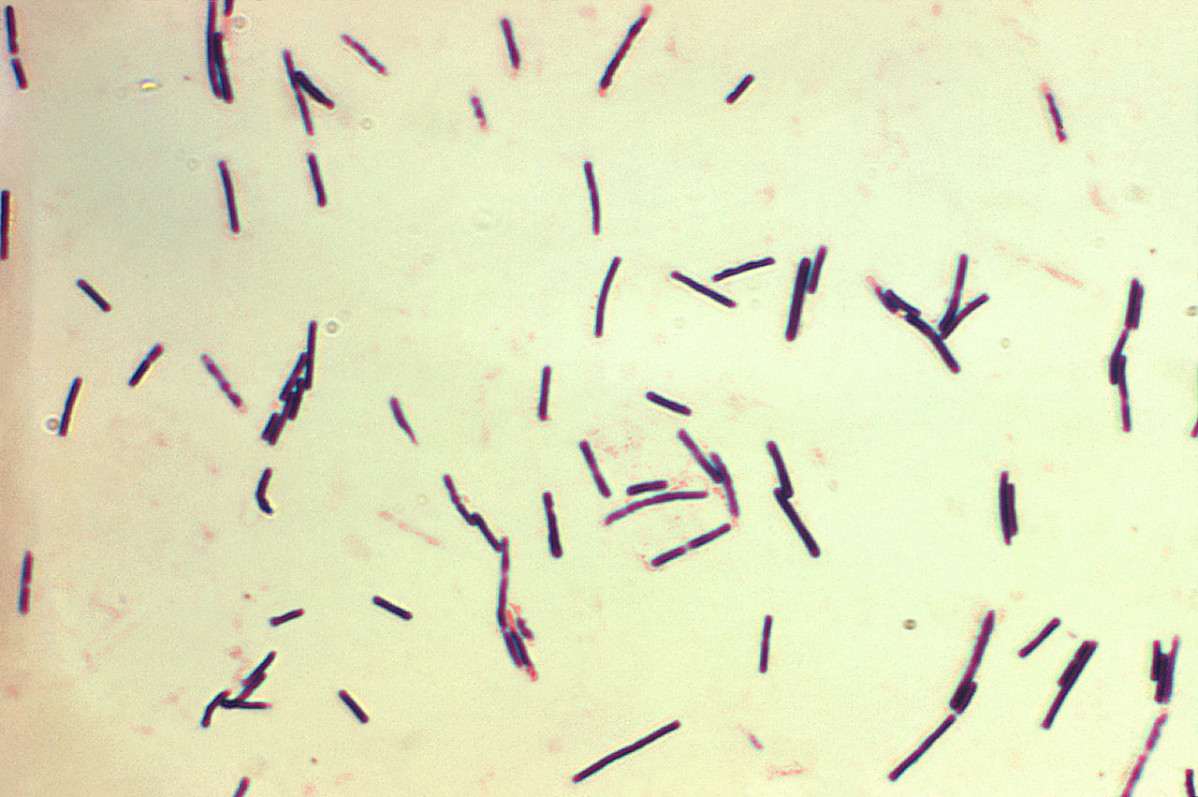 1280px Clostridium perfringens