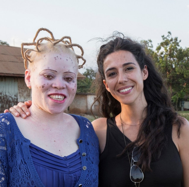 La fundadora de la ONG Beyond Suncare Mafalda Soto.