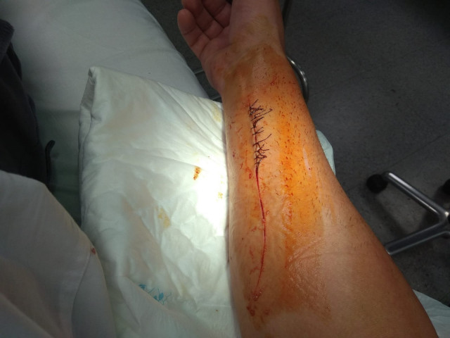 Agresión a uno de los vigilantes de un centro de menores de Ourense