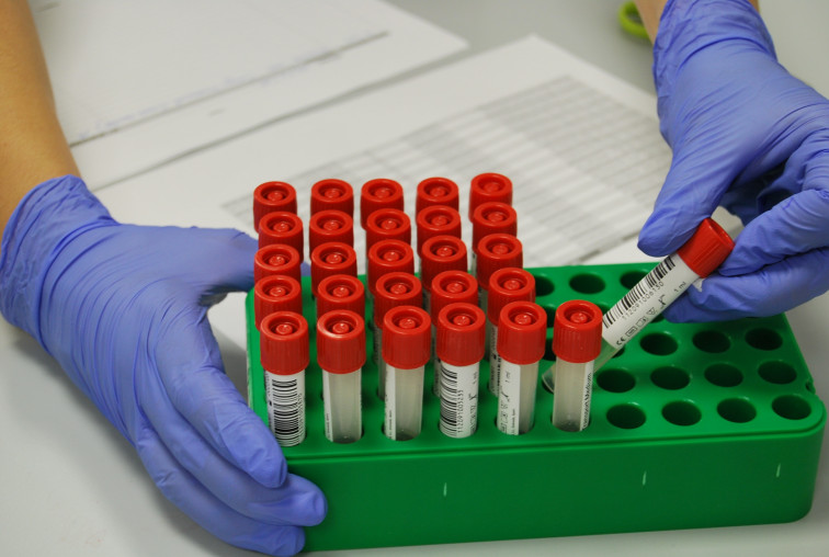 El cribado de A Limia concluye la 