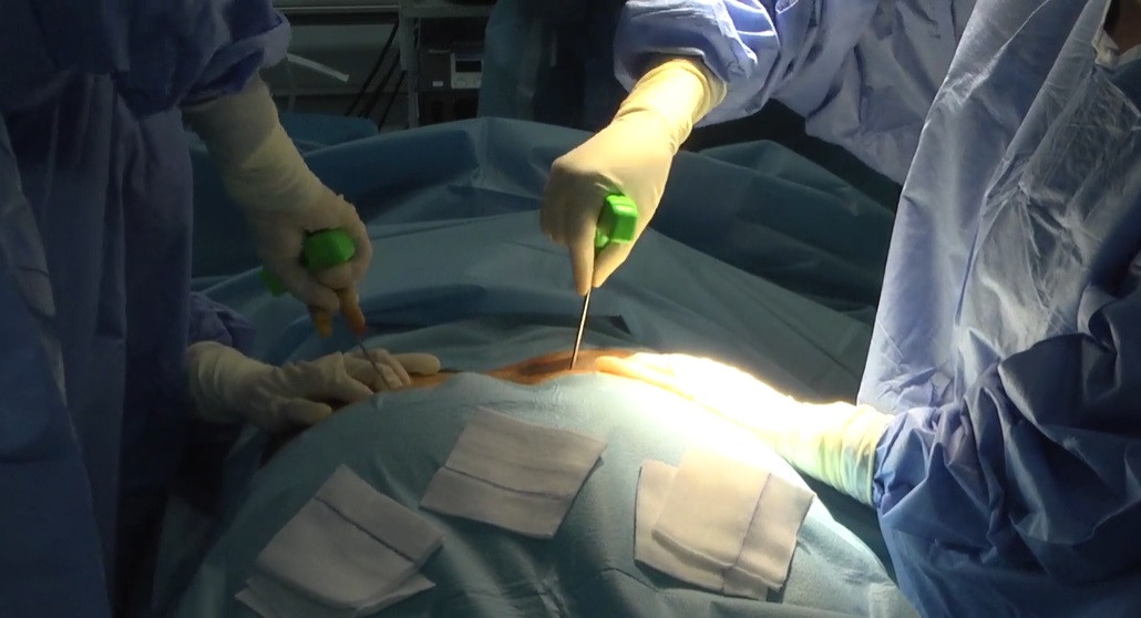 Archivo - Salud lanza cursos de donación y trasplantes con grabaciones de casos reales en quirófanos y consultas