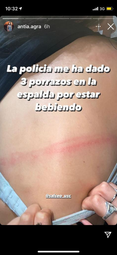 Porrazo en el costado de un estudiante publicado en instagram por salseo usc