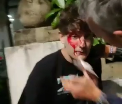 (Vídeos) Cargas, heridos y salvas de disparos en una noche de botellones e incidentes en Santiago