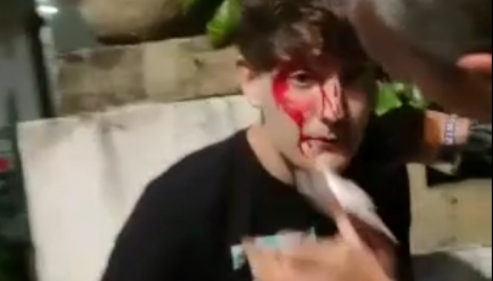 Captura de pantalla de un chaval herido en los incidentes de la noche de Santiago publicado en Instagram por Romaris