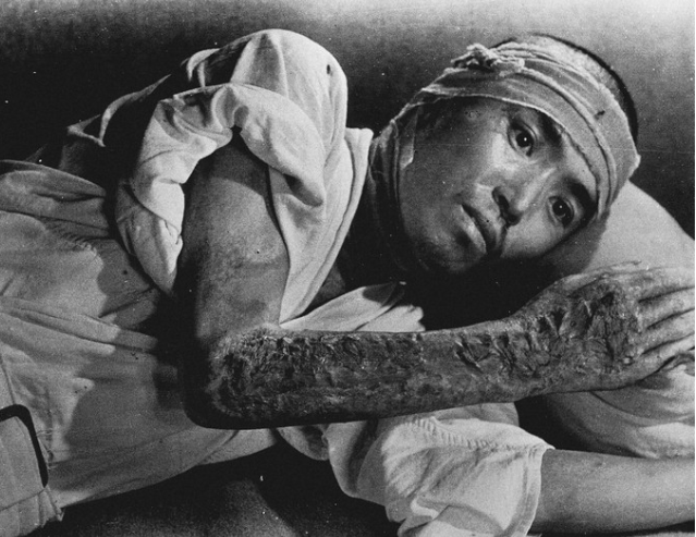 Víctima de la bomba nuclear de Nagasaki a dos kilómetros del epicentro en una foto de Shunkichi Kikuchi