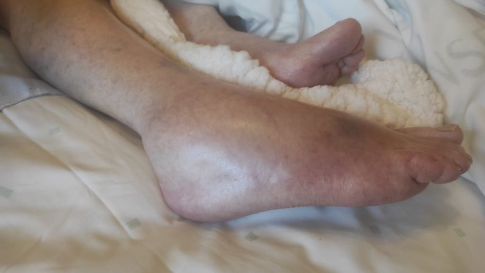 Foto del pie de la anciana difundida por Vellez Digna