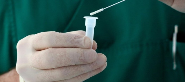 El estudio confirma que un porcentaje sustancial de pacientes infectados por SARS-CoV-2 puede tener resultados negativos en las pruebas serológicas en los meses posteriores a la infección.