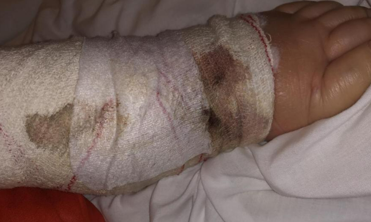 Venda sucia de una anciana de la residencia Mi Casa en una de las fotos enviadas por Vellez Digna a la Xunta y a la prensa