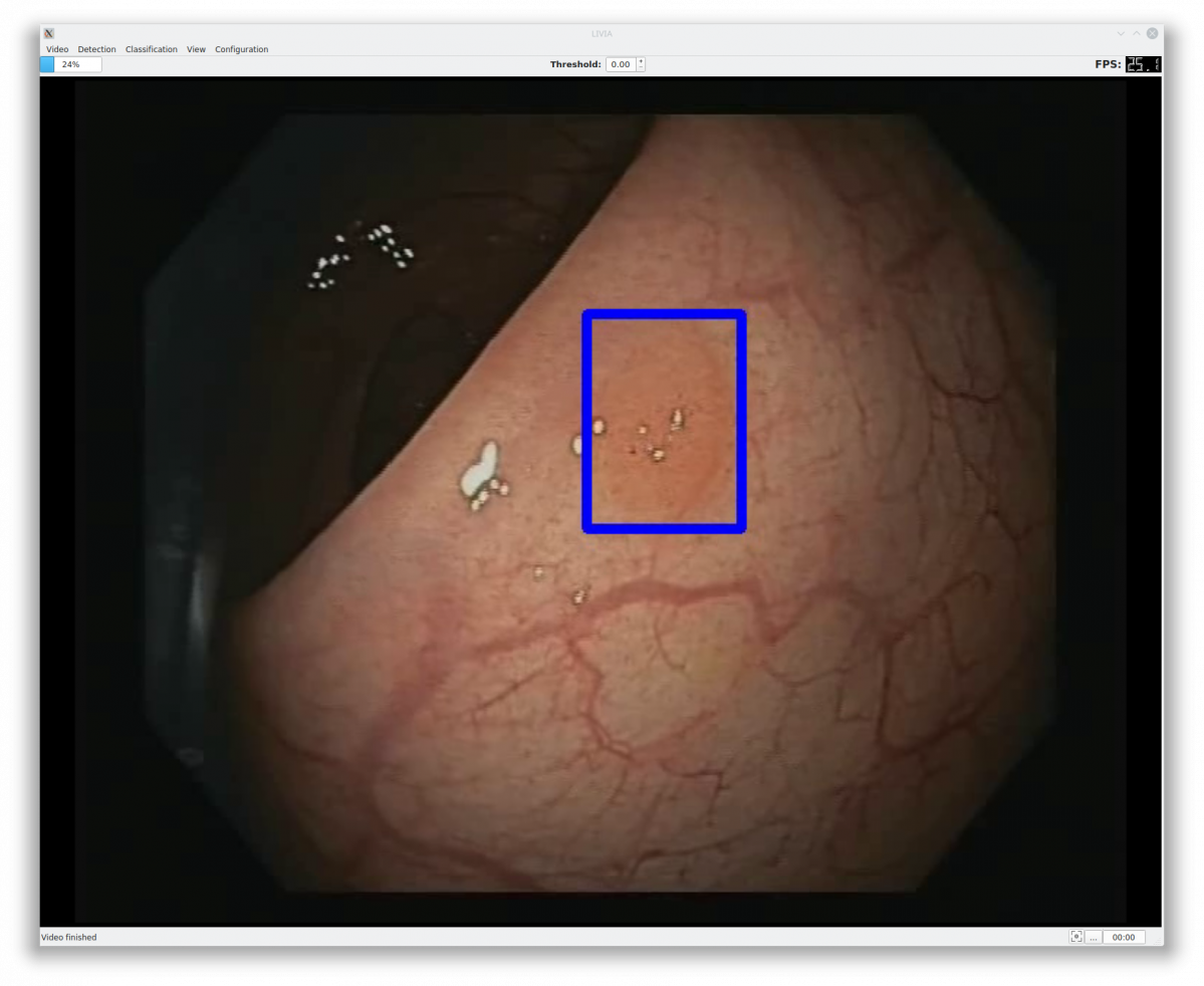 Imagen del sotware de la IA Polydeep en una imagen de su web