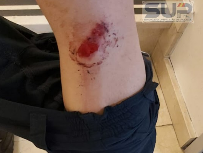 Policu00eda herido en la rodilla tras la lucha con los bateeiros en una imagen de SUP Galicia