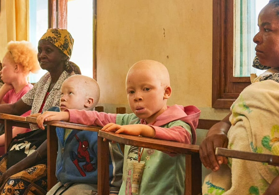 Personas albinas en Mozambique en una foto remitida por la organizaciu00f3n de XI Premios al Voluntariado Universitario