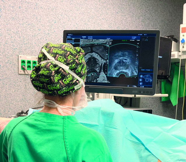 Imagen de una biopsia realizada en un hospital de HM hospitales