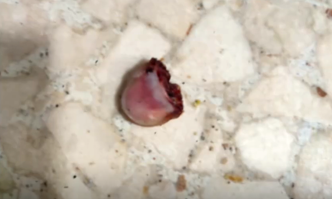 Dedo encontrado en una cafeteru00eda en una imagen difundida por CRTVG