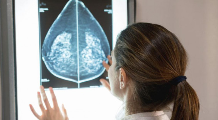 La negativa de la Xunta a dar los datos del cribado de cáncer de mama es ilegal, advierte Defensa da Sanidade