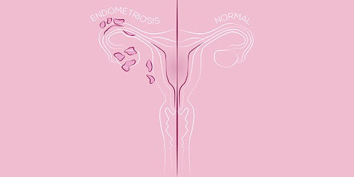 Archivo - Foto de archivo