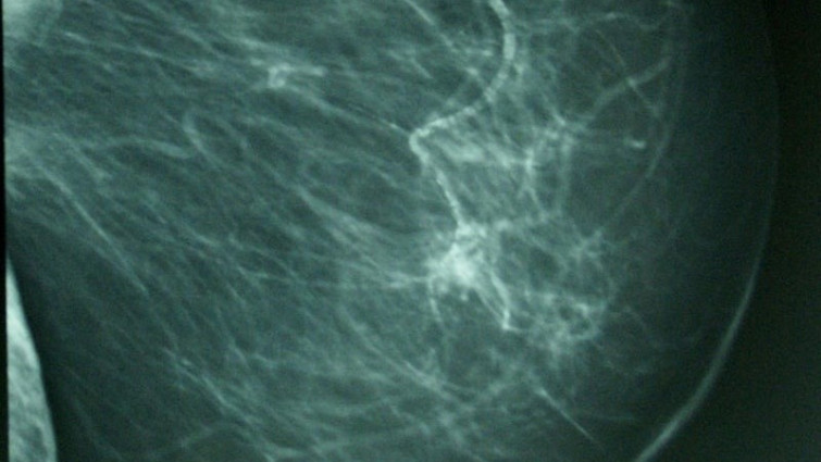 El Defensor del Paciente denuncia el caso de una mujer que 