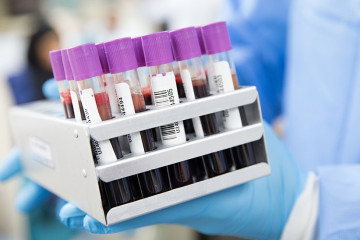 Archivo - Análisis de sangre. (Foto de recurso).