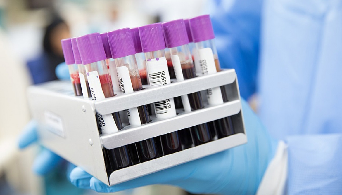 Archivo - Análisis de sangre. (Foto de recurso).
