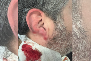 Herida del vigilante de seguridad agredido en el hospital de Oza