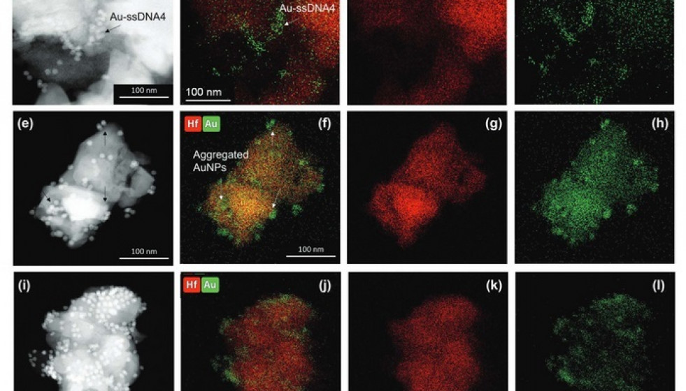 Archivo - Test rápido viruela del mono