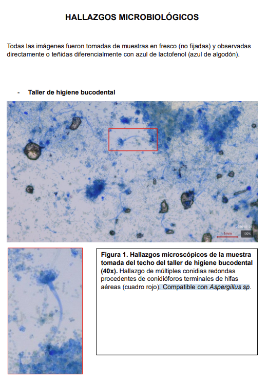 Parte del informe sobre los hongos hallados en el CIFP Manuel Antonio remitido por el profesorado