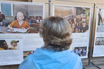 Exposición sobre la vida de personas con albinismo en África