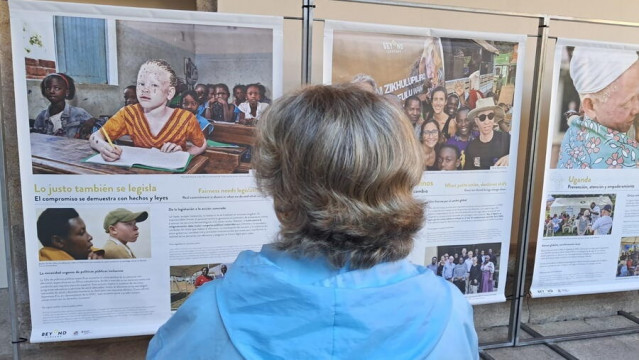 Exposición sobre la vida de personas con albinismo en África