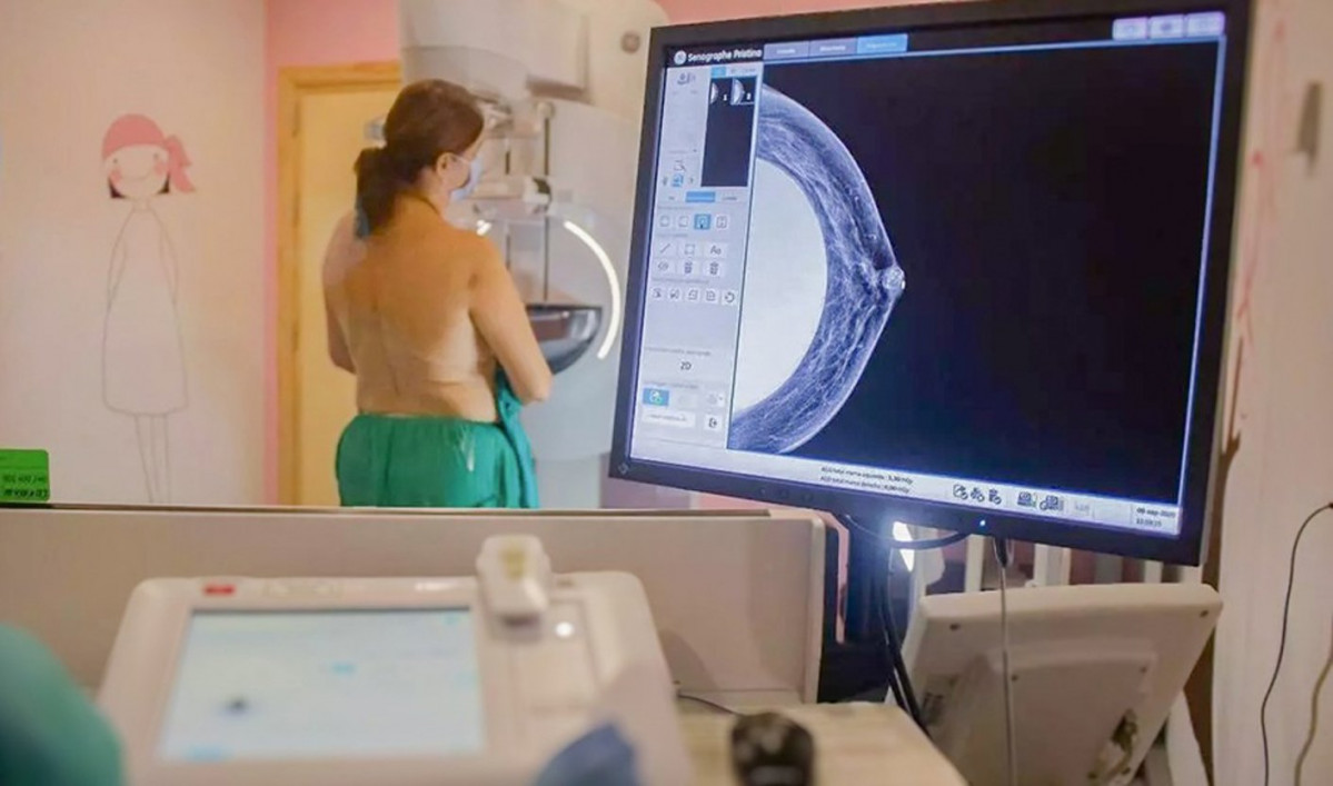 Prueba cu00e1ncer de mama