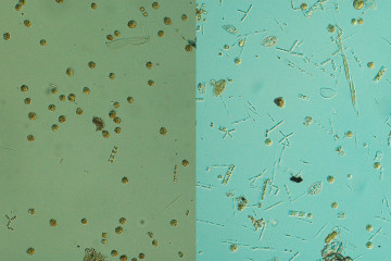 Estudio sobre algas nocivas