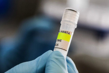 Hantavirus Foto RTVE