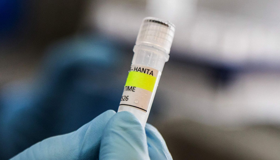 Hantavirus Foto RTVE