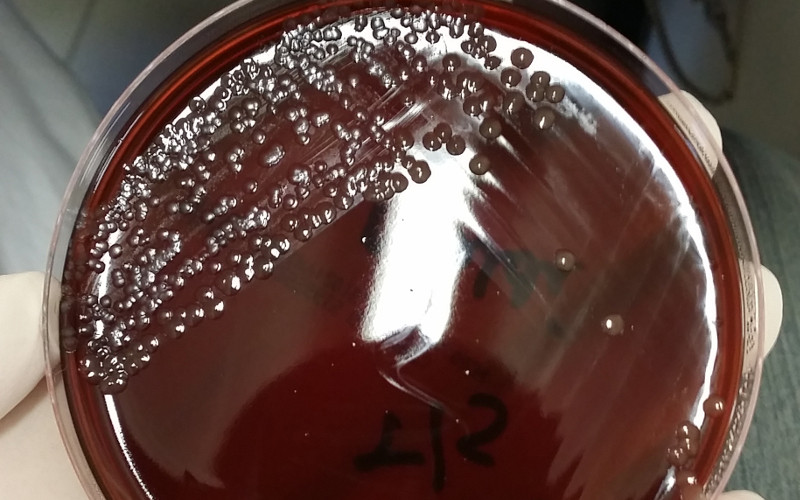 Cultivobacteriasenfermedad